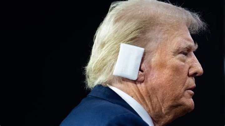 Trump with Ear Bandage: Understanding the Context and Implications